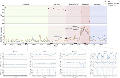 Fetal Cardiovascular Decompensation During Labor Predicted From the Individual Heart Rate Tracing: A Machine Learning Approach in Near-Term Fetal Sheep Model